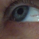 Illustration for article titled Aww, The Broken Blood Vessel In This Womans Eye Spells Love